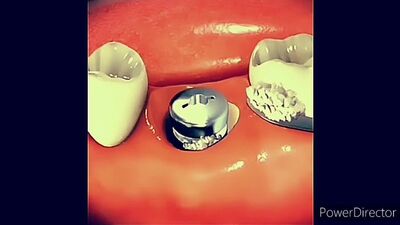 Video by Стоматология МЕДЕНТА Сибай, Магнитогорск