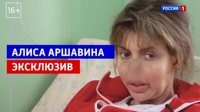 Алиса Аршавина объяснила, как лишилась носа – Андрей Малахов – Прямой эфир