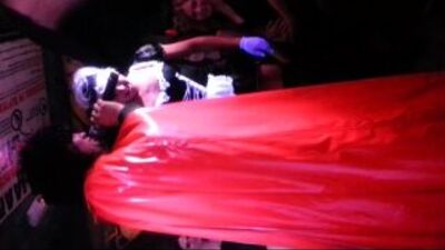 Женская волосатая грудь! Мечта однако всех парней!