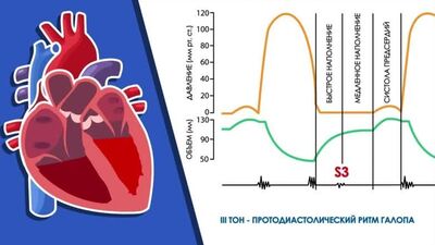 Аускультация сердца