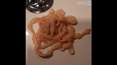 Ленточный червь (Cestoda) из кишечника человека