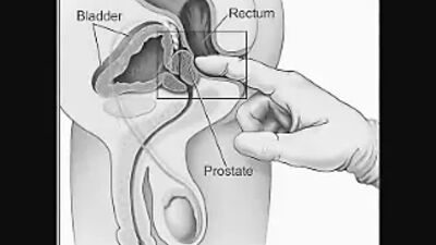 Как доить простату самостоятельно