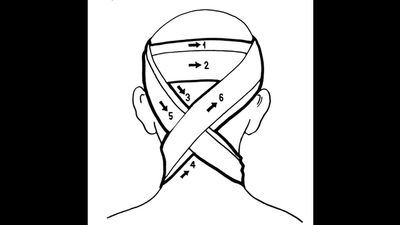 Техника наложения крестообразной повязки на затылок