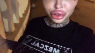 Bimbo big lips
